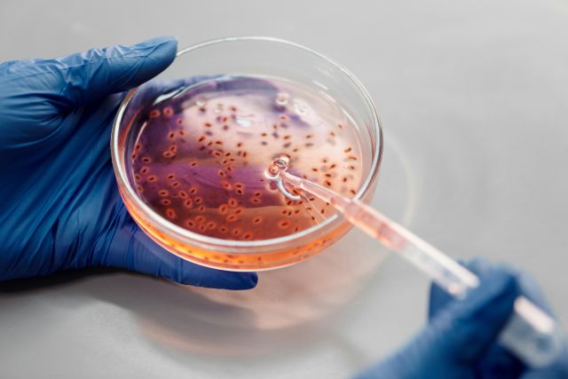Ilmuwan menemukan patogen purba penyebab wabah penyakit zoonosis
