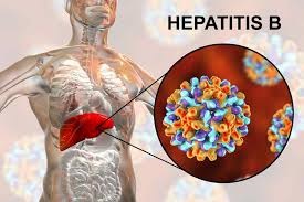 hepatitis b